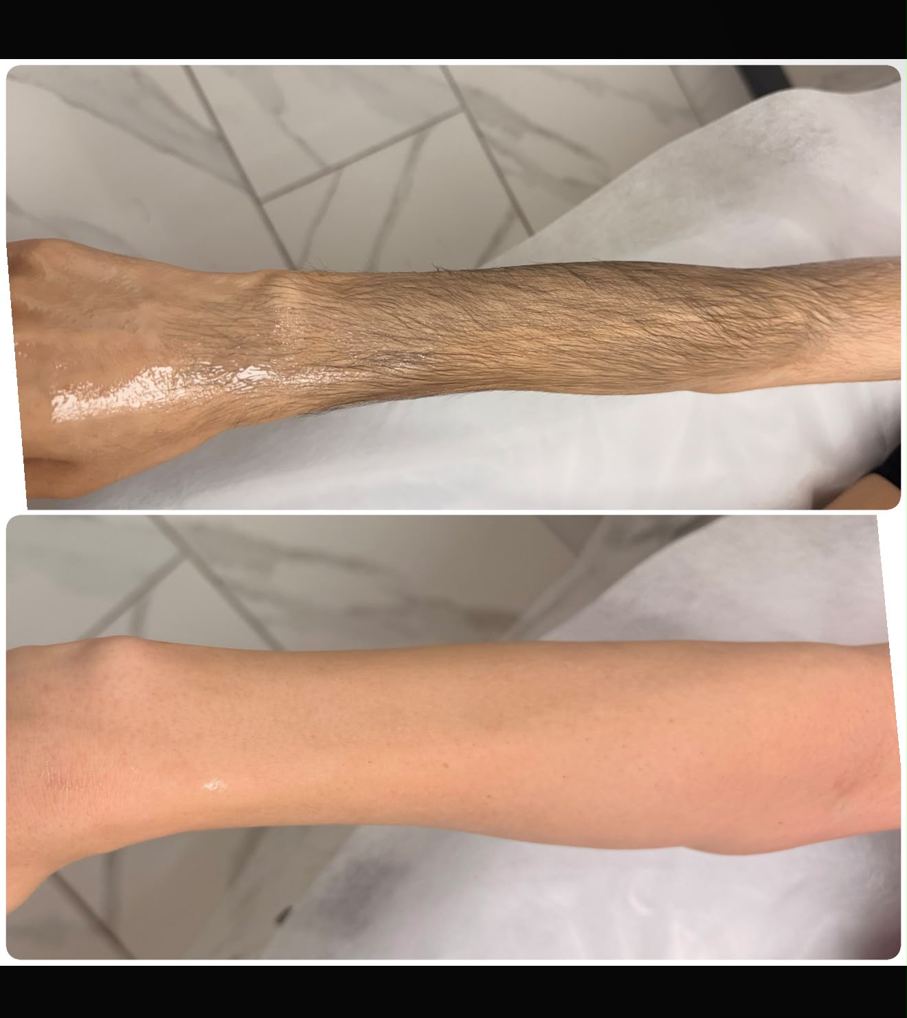 Men's forearm waxing before and after — full arm hair removal result at Magical Waxing Atlanta