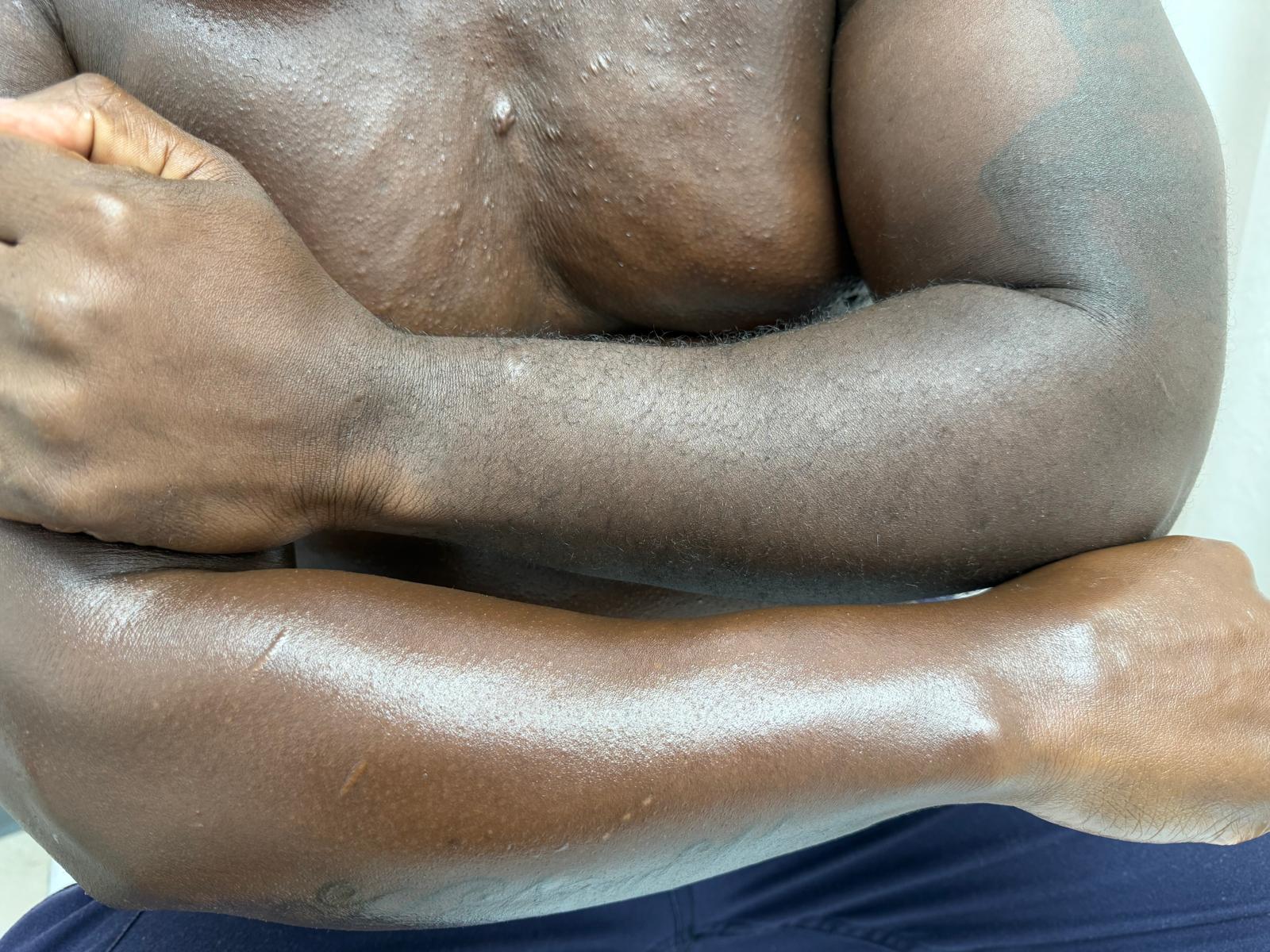 Men's chest and arm waxing smooth result close-up at Magical Waxing Atlanta