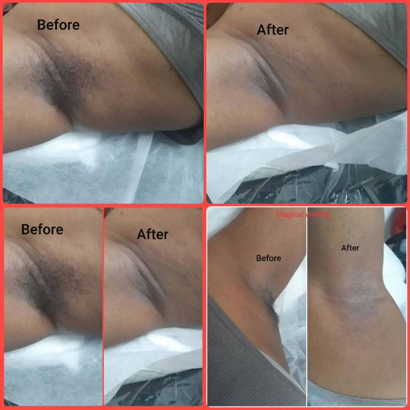 Multiple underarm waxing before and after results at Magical Waxing - showcasing consistent smooth results